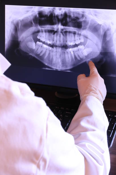 Best Emergency Dental Care for Broken or Chipped Teeth in Ogden, IA